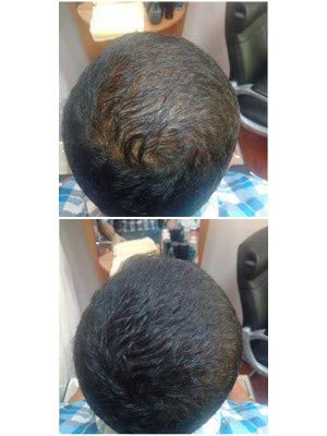 Nanogen Hair Fibres - Dark Brown, 30 g | Keratin Hair Thickener | Unisex 2