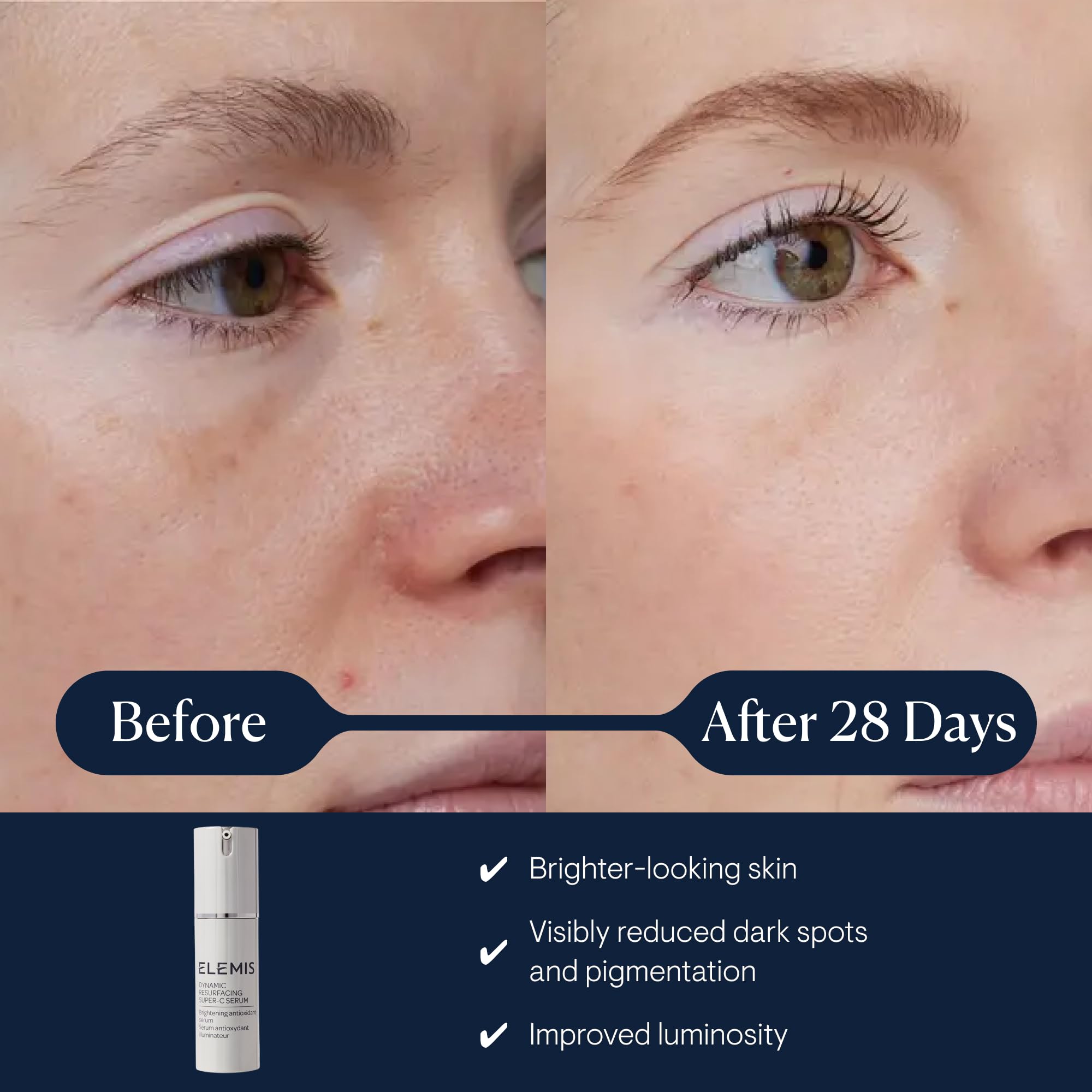 Elemis Dynamic Resurfacing Super-C Serum - Brightening Antioxidant Vitamin C | 30ml 2
