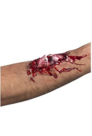 Cicatriz de hueso roto
